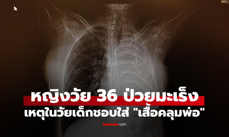 ช็อกสุดขีด! สาว 36 เจอมะเร็งร้ายจาก เสื้อคลุมพ่อ วัยเด็ก หมอบอกเหลือชีวิตแค่ 15 เดือน?!